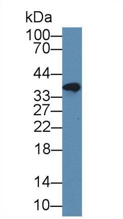 14025