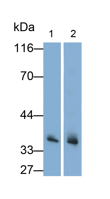 31012