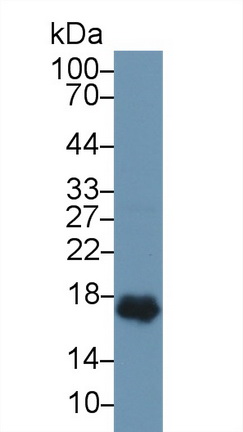 14954
