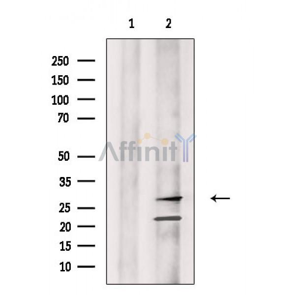 Валидация Affinity DF2378 - 12963