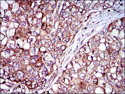 Валидация AntibodySystem RHN93401 (3960)