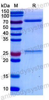 Валидация SDS-PAGE - AntibodySystem FMJ93270