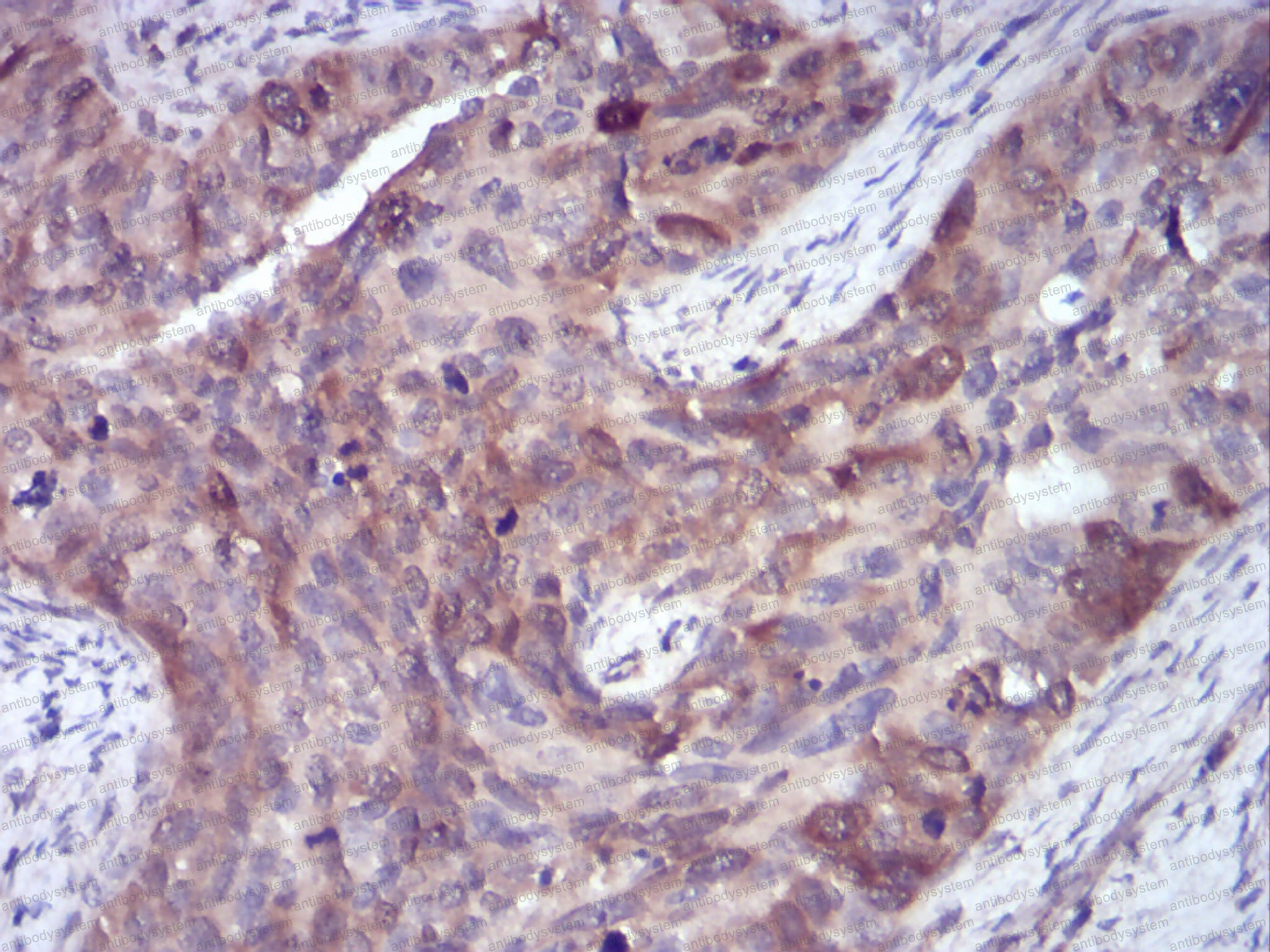 Валидация AntibodySystem RHD03302 (1285)