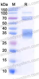 EHC84101, SDS-PAGE