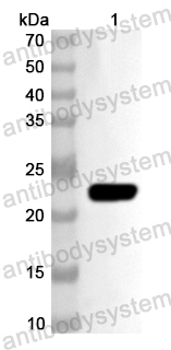 Валидация AntibodySystem PHA92001