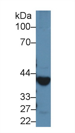 13542