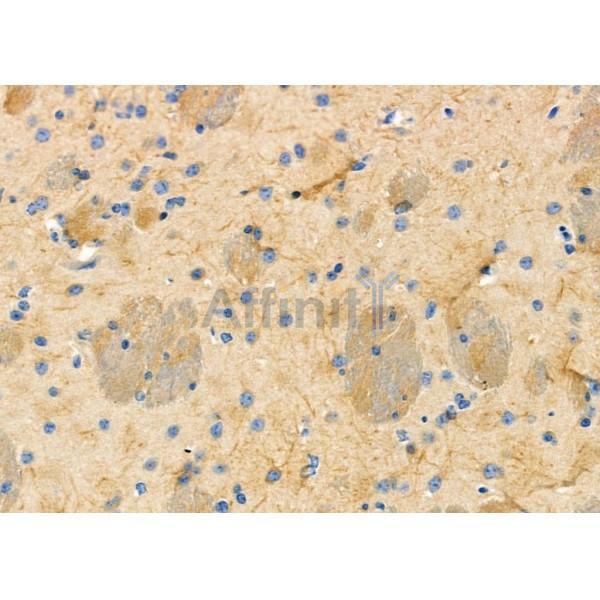 Валидация Affinity DF10110 - 5616