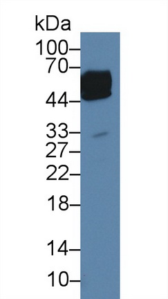 14005