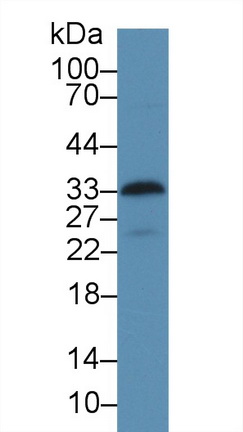 13925
