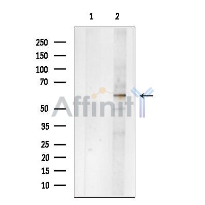 Валидация Affinity DF6671 - 18157