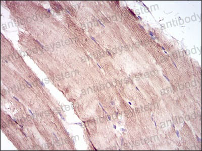 Валидация AntibodySystem RHK37401 (3648)