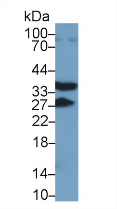 13657