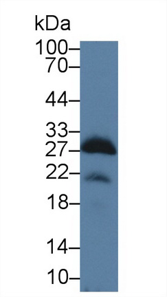 14284