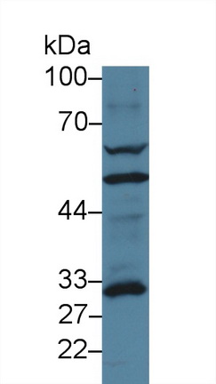13911