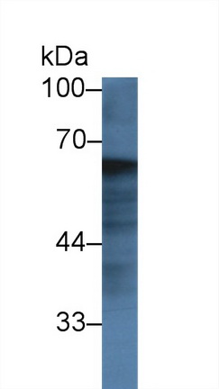 14339