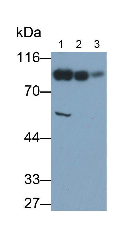 30872