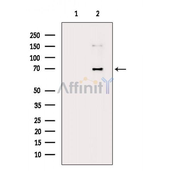 Валидация Affinity AF6417 - 3717