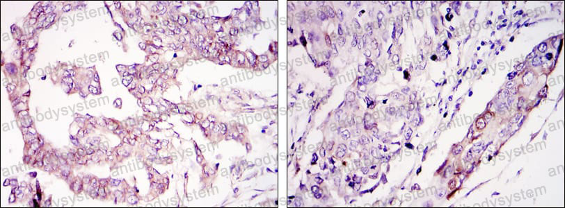 Валидация AntibodySystem RHN58202