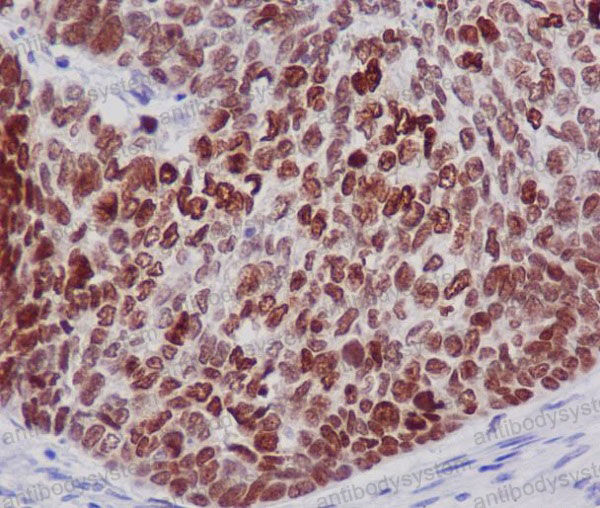 Валидация AntibodySystem RHB01302