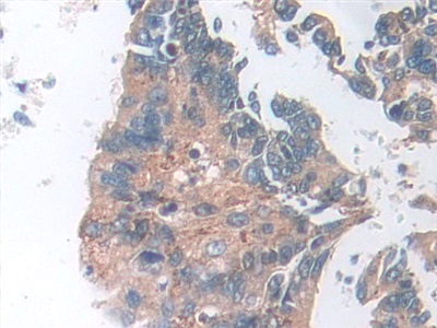 16666