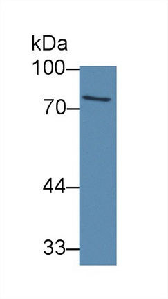 12818