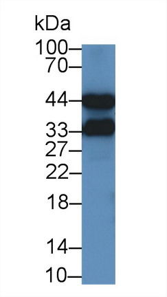 14666