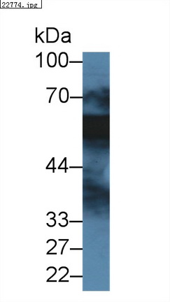 14388