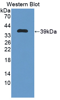 41125