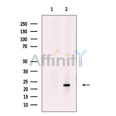 Валидация Affinity DF13666 - 9236