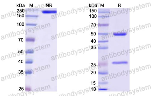 Валидация SDS-PAGE - AntibodySystem DHG76501