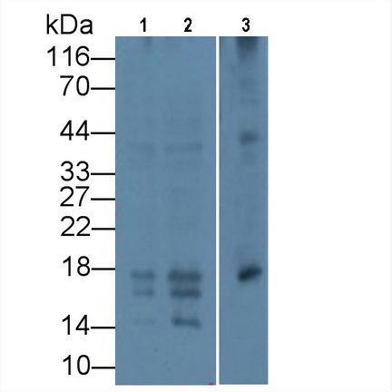62725