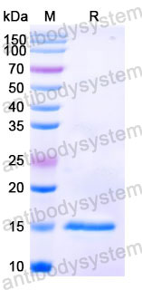 Валидация SDS-PAGE - AntibodySystem RHC45301
