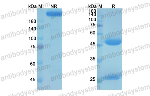 Валидация SDS-PAGE - AntibodySystem DHJ48301