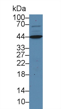17617