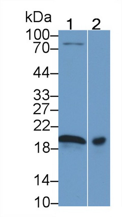 21380