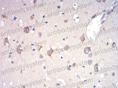 Валидация AntibodySystem RHA83002 (219)