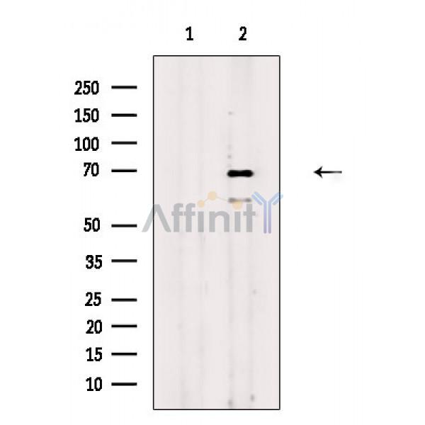 Валидация Affinity DF8756 - 20773