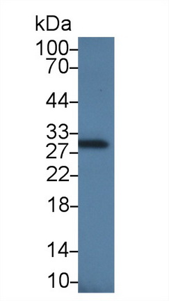 14470