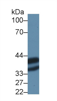14143