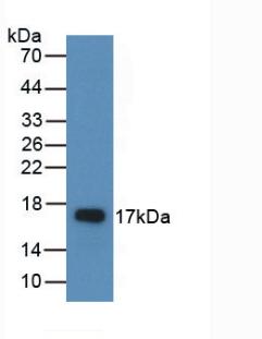 38582