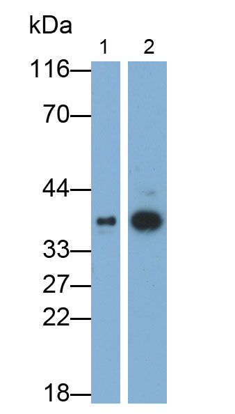14218