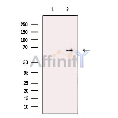 Валидация Affinity DF13287 - 8408