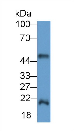 62140