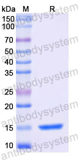 Валидация SDS-PAGE - AntibodySystem RHD10804