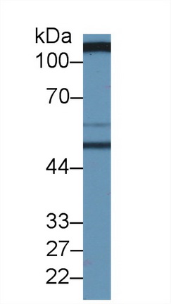 14416
