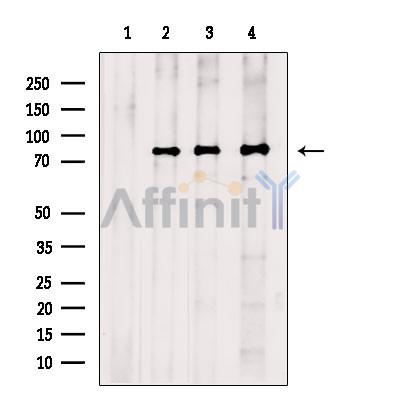 Валидация Affinity DF13609 - 9112