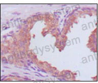 Валидация AntibodySystem RHC24203 (819)