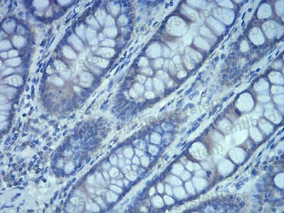 Валидация AntibodySystem RHD39303