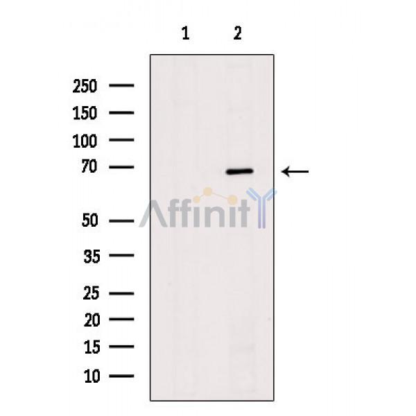 Валидация Affinity AF6395 - 3688