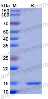 Валидация SDS-PAGE - AntibodySystem RHC09605